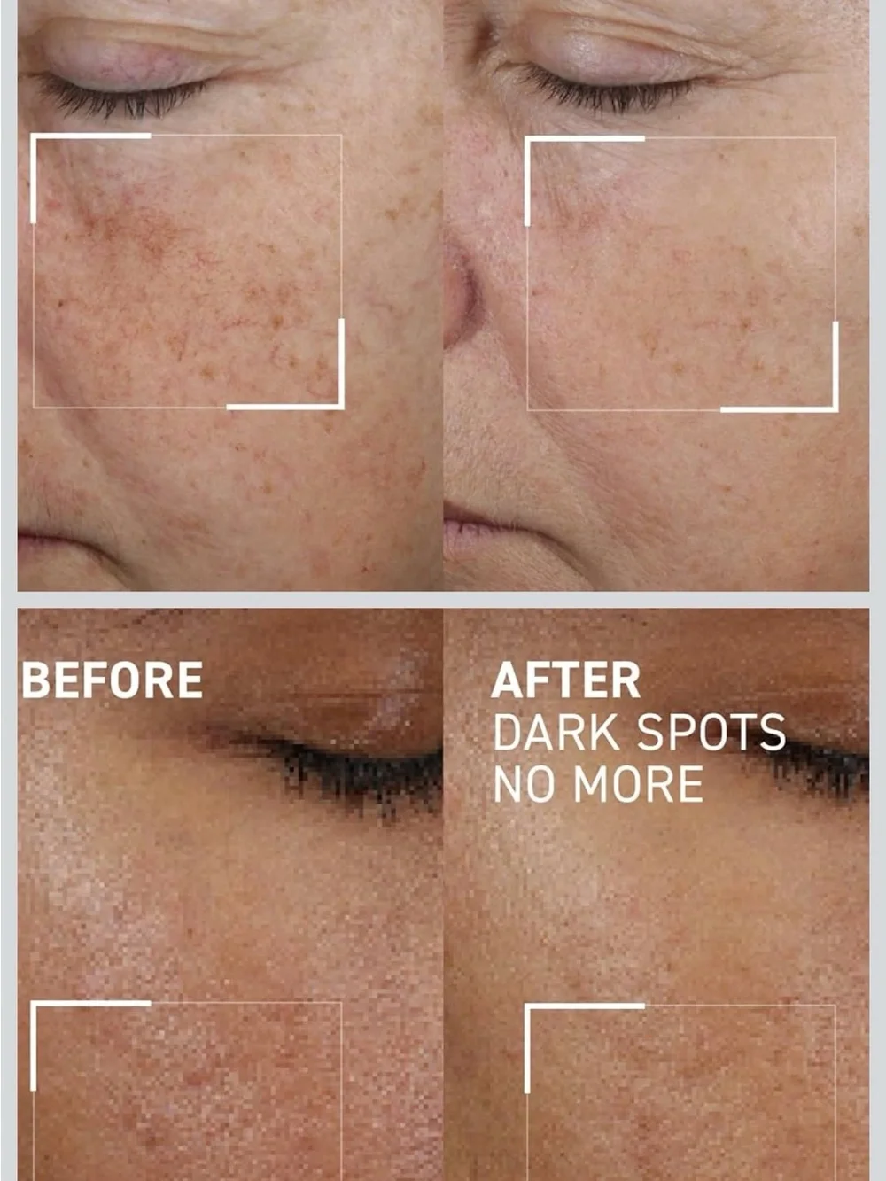 Dr. Brandt White to Yellow Dark Spots No More Triple Acid Concentrate